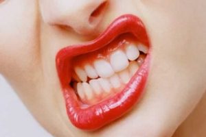 Diş gıcırdatma probleminiz nasıl son bulur?