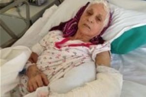 Hastanede kol kırığı 11 g&uuml;n sonra fark edildi