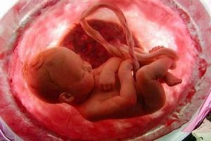 IUGG nedir, neden gelişir?