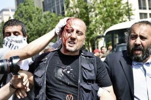 Polis Ahmet Şık'ı başından vurdu