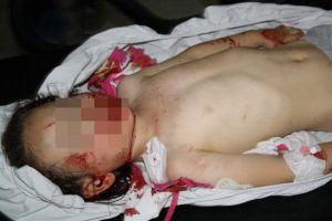 3. kattan d&uuml;şen &ccedil;ocuk ağır yaralandı
