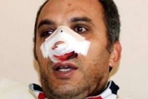 Eylemciler, 'sivil polis' diye &ouml;ğretmeni hastanelik etti
