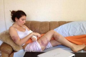 Yediği dayağın fotoğrafları Twitter'da