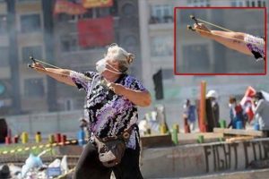 Sapanlı teyze hastanelik oldu