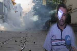 "G&ouml;z&uuml;m&uuml; kaybettiğim i&ccedil;in &uuml;z&uuml;lm&uuml;yorum"
