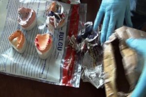 Diş protezlerinin i&ccedil;inden esrar &ccedil;ıktı