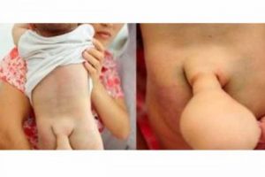 Kuyruklu bebek g&ouml;renleri şaşırtıyor