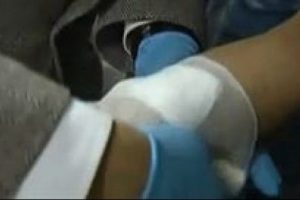 Kanamayı 30 saniyede durduran yara bandı