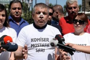 Burnu kırılan CHP Milletvekili'nden a&ccedil;ıklama