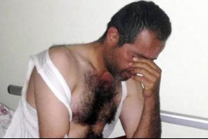 15 g&uuml;n elma yiyerek hayatta kaldı