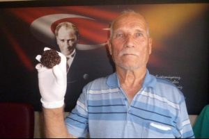 Doktorları bile şaşırttı