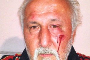 Belediye Başkanı gazeteci yumrukladı