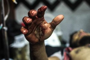 Mısır'daki siyasi partiler de katliamı kınadı