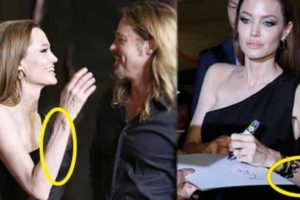 Angelina bir deri bir kemik kaldı