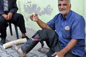 Para olmayınca kesik bacağına bakın ne yaptı?