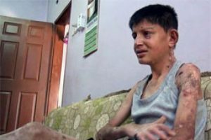 V&uuml;cudundaki yaralar kaşıdık&ccedil;a kanıyor