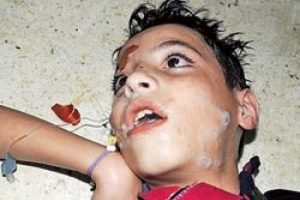 Esad sarin gazı mı kullandı?