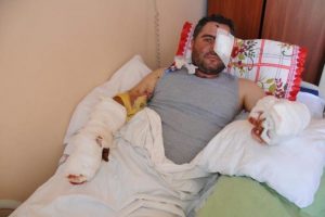 İnternetten bakarak yaptığı patlayıcı hayatına mal olacaktı