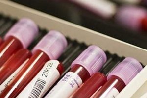 Doping yapana hapis cezası