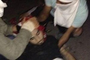 'D&uuml;şme yok' diyen doktor konuştu