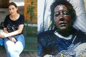 Eşini haşlayan kocaya m&uuml;ebbet istemi!