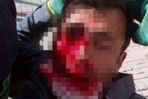 Emniyet TTB'den g&ouml;z&uuml;n&uuml; kaybedenlerin isimlerini istedi