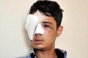 K&ouml;r eden polise ceza