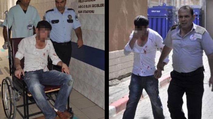 Yağmurdan ka&ccedil;arken doluya tutuldu