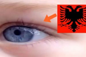 G&ouml;zlerindeki şekle &ccedil;ok şaşıracaksınız