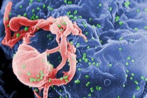 Yeni t&uuml;r AIDS vir&uuml;s&uuml; Rusya'dan yayılıyor