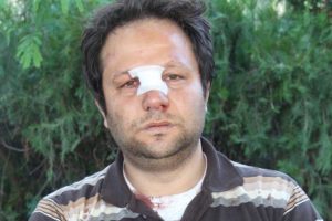 Okuldan atılınca &ouml;ğretmeninin burnunu kırdı
