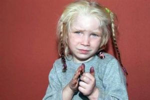 4 yaşındaki kız i&ccedil;in 10 bin başvuru