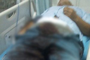 Depresyona girince penisini doğradı!