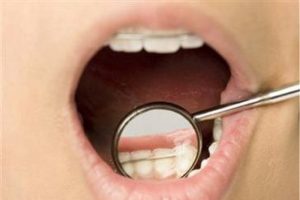 Ortodontide yeni sistem
