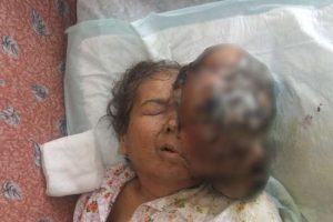 7 kilogramlık t&uuml;m&ouml;r &ouml;ld&uuml;rd&uuml;