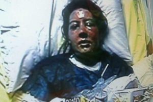 Kendini bu hale getiren kocasından şikayet&ccedil;i