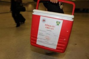Organ naklinde bilinmesi gerekenler