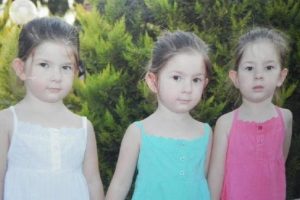 Yaşamaz dedikleri tek yumurta &uuml;&ccedil;&uuml;zleri 4 yaşında