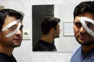 Kornea bağışına yeni d&uuml;zenleme
