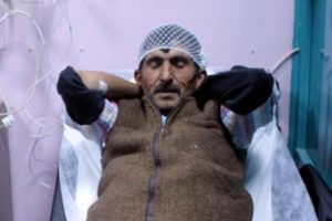 Komşusunun kafasına keserle vurdu