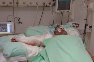 Otomatik kapı kolunu kopardı