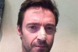 Hugh Jackman deri kanserine yakalandı