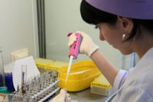 20 bin kişi AIDS'den &ouml;ld&uuml;