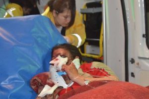 Kadın &ouml;ğretmen feci şekilde d&ouml;v&uuml;ld&uuml;