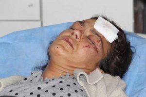 "Alkol alma" dedi, bu hale geldi