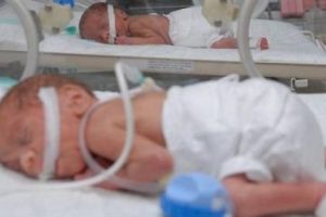 İkizinden 8 g&uuml;n sonra doğdu