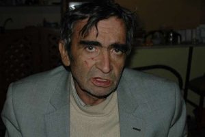 Isınmak i&ccedil;in yanan sobaya sarıldı