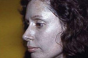 60 yıldır cildi gri peki neden?