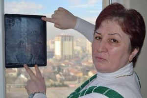 Karnında iğne unutuldu davası 2 yıldır s&uuml;r&uuml;yor
