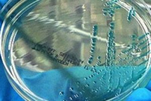 H10N8 kuş gribi vir&uuml;s&uuml; insana bulaştı